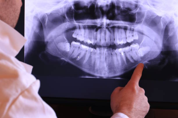 Best Emergency Dental Care for Broken or Chipped Teeth in Chubbuck, ID