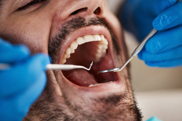 Best Cosmetic Emergency Dentistry in Chubbuck, ID